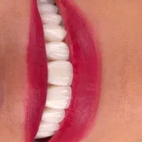 درمان و زیبایی دندان