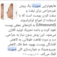 دستگاه هایفو|پزشکی|کارون, |دیوار