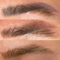 ریموو(پاک کردن تاتو) صورت وبدن با لیزر پیشرفته|خدمات آرایشگری و زیبایی|تبریز, |دیوار