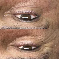 پاکسازی۱۴مرحله اقاوخانم کلینیک پزشک روشنی تضمینی|خدمات آرایشگری و زیبایی|بیرجند, |دیوار