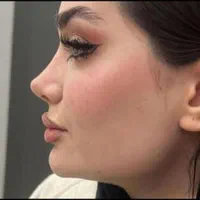 جشنواره اف ویژه عمل زیبایی بینی توسط متخصص