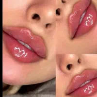 جشنواره تخفیفات ژل بوتاکس دکترکاظمی|خدمات آرایشگری و زیبایی|مشهد, کوثر|دیوار