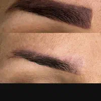 خدمات تخصصی پاکسازی (ریموو)