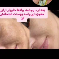 درمان ناهنجاری پوست و آموزش خاویار تراپی|خدمات آرایشگری و زیبایی|شیراز, باهنر|دیوار