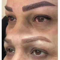 خواهان یک مدل برای فیبروز به روش نانوبلیدینگ