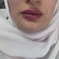 ژل لب روفیل