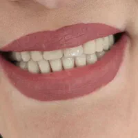 دندانسازی بانو دنت.با چک|خدمات آرایشگری و زیبایی|تربت‌حیدریه, داروپخش|دیوار