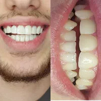 کامپوزیت زیبایی|خدمات آرایشگری و زیبایی|اسلام‌شهر, شهرک قائمیه|دیوار