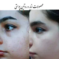 محصولات آرایشی
