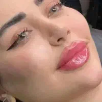 جشنواره زیبایی شب یلدا فیلر لب بوتاکس ژل پی آر پی