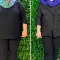 بوتاکس معده و دستگاه های لاغری