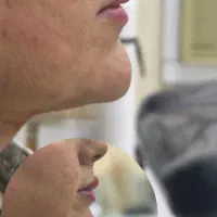 تنها مرکز تخصصی ساکشن غبغب در آبادان