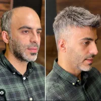 پروتز مو|خدمات آرایشگری و زیبایی|دهگلان, |دیوار