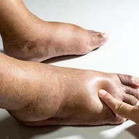 مشکلتون به من بگو تا برات حلش کنم مشاوره سلامتی|آرایشی، بهداشتی، درمانی|تهران, بهار|دیوار