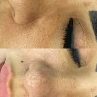 پاکسازی و فیشیال تخصصی فقط بانوان