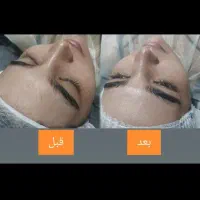 فیشال و پاکسازی پوست|خدمات آرایشگری و زیبایی|نیشابور, هفده شهریور|دیوار