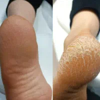 صفر تا صد کار پا