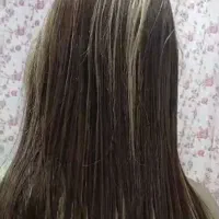 ویال تراپی ساقه مو وکف سر برای رشد واسیب|خدمات آرایشگری و زیبایی|خمام, |دیوار