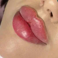 آف خدمات فیلر بادی کاشت ابرو پرولیفت و...|خدمات زیبایی و سلامت|کرج, گوهردشت|دیوار