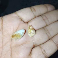 مهره