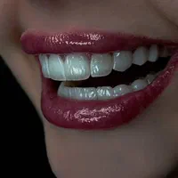 کامپوزیت ، لمینیت با بهترین کیفیت و اقساط (تهران)|خدمات آرایشگری و زیبایی|اراک, |دیوار