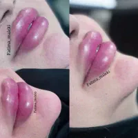 آفر ویژه آموزش حرفه ای فیلر و بوتاکس تا آخر هفته|خدمات آموزشی|تهران, هفت حوض|دیوار