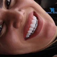 کامپوزیت دندان