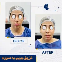 جشنواره تابستانی ۵۰٪ بلفارو پلاستی .تیپ پلاستی|خدمات آرایشگری و زیبایی|تهران, مهران|دیوار