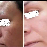 کرم چهل گیاه معجزه|آرایشی، بهداشتی، درمانی|شیراز, انجیر|دیوار