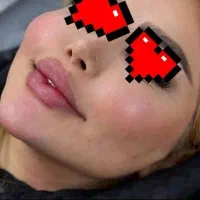 آموزش ژل وبوتاکس|خدمات آرایشگری و زیبایی|اهواز, فاز ۲ پادادشهر|دیوار