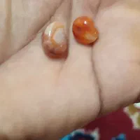 مهره