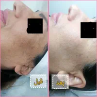 تخفیف آموزش فیشال فیشیال پاکسازی با پکیج متفاوت|خدمات آموزشی|شیراز, سینما سعدی|دیوار