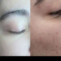 کرم معجزه اصل ۳عدد زیرقیمت|آرایشی، بهداشتی، درمانی|شیراز, شاپورجان|دیوار