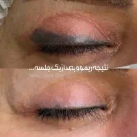 ریموو تخصصی تتوی ابرو و خط چشم و بدون آسیب|خدمات آرایشگری و زیبایی|بم, |دیوار