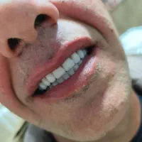 دندان مصنوعی وارداتی هر فک ۵ تومان|خدمات آرایشگری و زیبایی|کرج, کمالشهر|دیوار