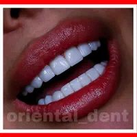 دندانپزشکی/کامپوزیت دندان/ترمیم/روکش/عصبکشی|خدمات آرایشگری و زیبایی|تهران, تهرانپارس شرقی|دیوار