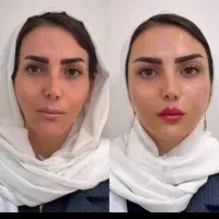 خدمات زیبایی|خدمات آرایشگری و زیبایی|ایذه, |دیوار