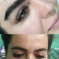 جشنواره کاشت ابرو سوپر لیفت نچرال(میکرو کاشت)