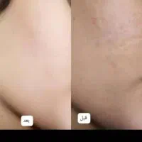 کرم ویتامینه وآبرسان قوی ضدلک وکک ومک معجزه|آرایشی، بهداشتی، درمانی|اهواز, دغاغله|دیوار