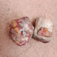 سنگهای فیروزه