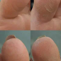 پدیکور تخصصی۳۰درصد تخفیف با معرفی نفر دوم|خدمات آرایشگری و زیبایی|شیراز, مسلم|دیوار