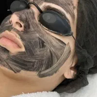 کربن تراپی پیلینگ هالیوودی روشن سازی نواحی تیره