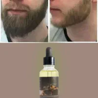 با این سرم ریشات میشه جنگل