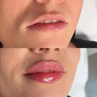 تخفیف لیزر موهای زائد تا آخر هفته  ۳۹۰ تومان|خدمات آرایشگری و زیبایی|کرج, گوهردشت|دیوار