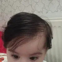 درمان قطعی شپش موی سر کاملا تضمینی