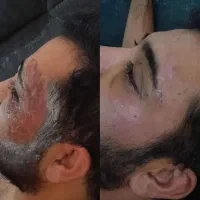 زانو درد چاقی لاغری ریزش مو کبد