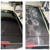 رفع آفتاب سوختگی سیار