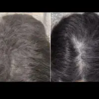 کلینیک زیبا شو راهی است بسوی زیبایی شما