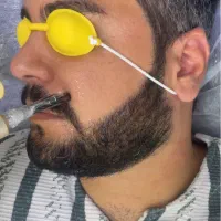 لیزر،الکترولیز مو زائد آقایان، کک و مک توسط پزشک