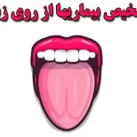 تشخیص سونوگرافی از روی زبان